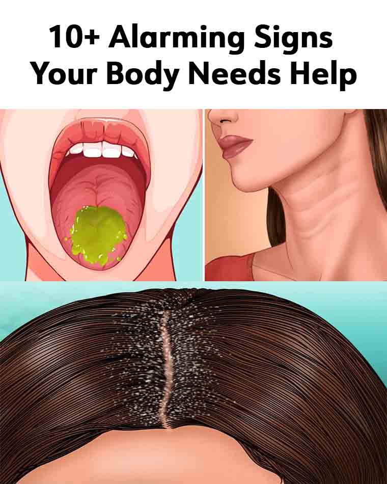 10+ Alarming Signs Your Body Needs Help - Wake Up Your Mind