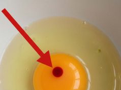 I Found Red Spots in My Eggs — Are They Safe to Eat or Should I Throw Them Away?