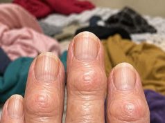 Why is this spreading?